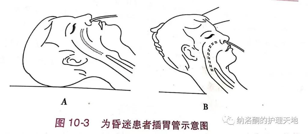 2025年天天彩资料大全和00后女孩自学插胃管与00后女孩自学插胃管视频