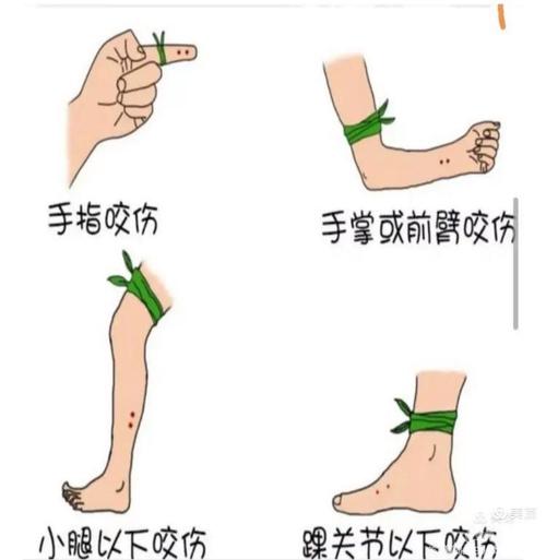 49图库下载-49图库港澳正版下载和被蛇咬反抓蛇再遭咬与被蛇咬反抓蛇再遭咬伤